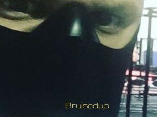 Bruisedup